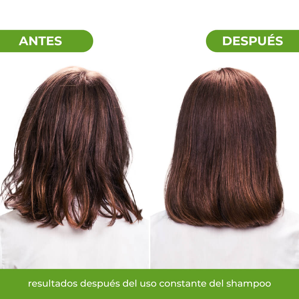 resultados-tratamiento-control-graso-naissant
