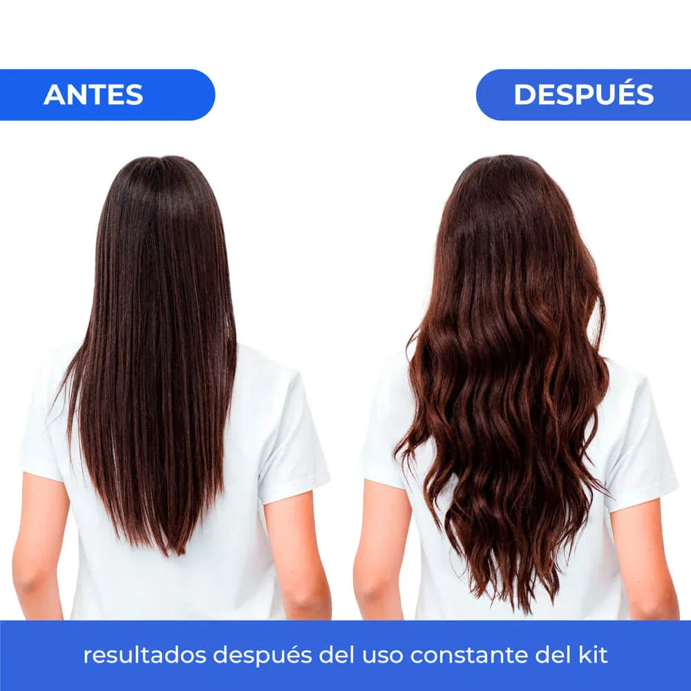 resultados-tratamiento-crecimiento-capilar-energy-naissant